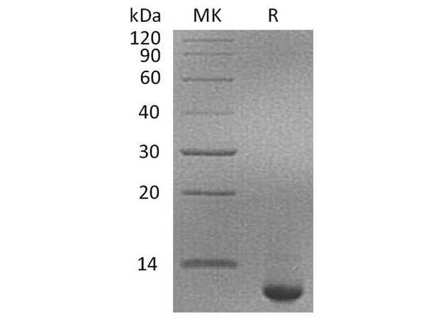 Human SPINK4 Recombinant Protein (RPES2631)