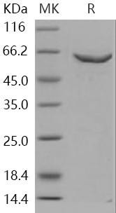 Human DNMT2/TRDMT1 Recombinant Protein (GST Tag) (RPES2635)