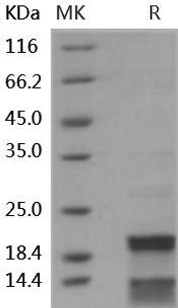 Human CASP7/caspase 7 Recombinant Protein (RPES2637)