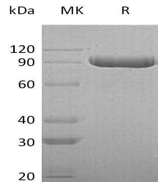 Human ITIH3 Recombinant Protein (RPES2666)