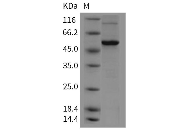 Mouse VDR/NR1I1 Recombinant Protein (His Tag) (RPES2681)