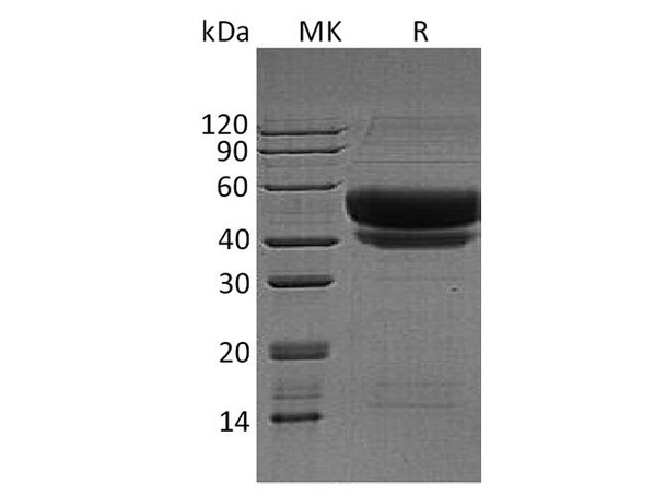 Human ST6GAL1 Recombinant Protein (RPES2736)