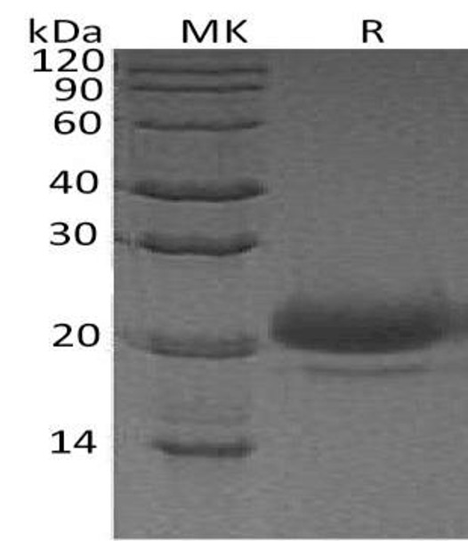 Human WFDC2/HE4 Recombinant Protein (RPES2751)