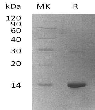 Human WBP2 Recombinant Protein (RPES2809)
