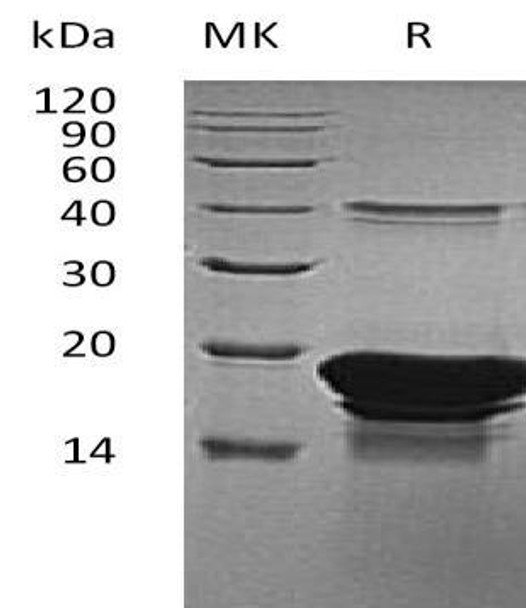 Human EDF1/MBF1 Recombinant Protein (RPES2826)