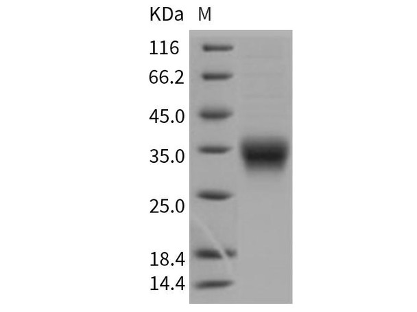 Mouse CD8a/Lyt2 Recombinant Protein (His Tag) (Active) (RPES2830)
