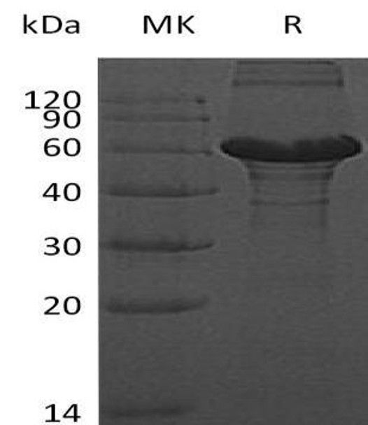 Human ZBTB9 Recombinant Protein (RPES2913)