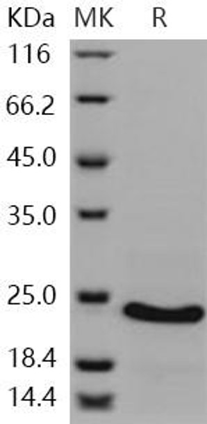 Human CSRP1 Recombinant Protein (His Tag) (RPES2960)