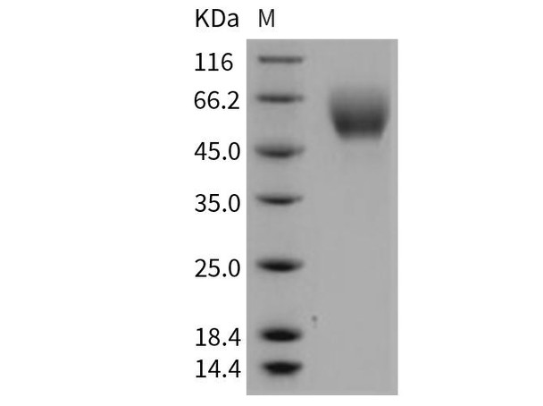 Mouse SerpinA6/CBG Recombinant Protein (His Tag) (RPES2962)