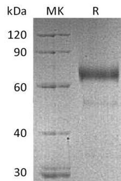 Human KIR2DL3/NKAT2 Recombinant Protein (RPES2987)