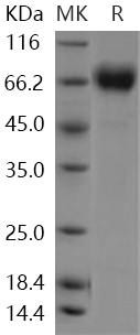 Human CD68/Macrosialin Recombinant Protein (aa 1-319, His Tag) (RPES2997)