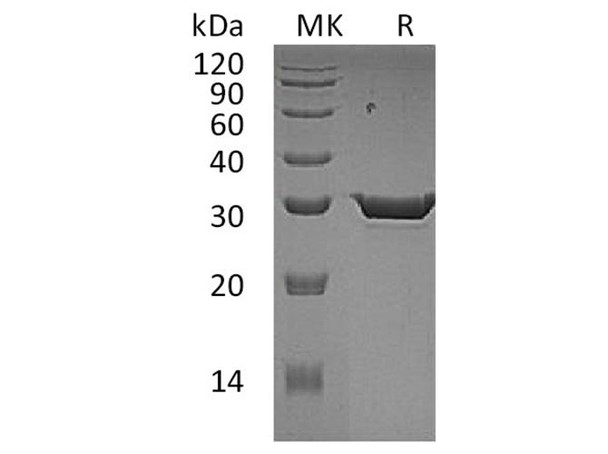 Human 15-PGDH Recombinant Protein (RPES3031)