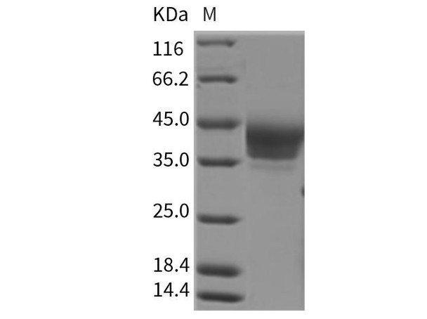 Rat B7-H6/NCR3LG1 Recombinant Protein (RPES3079)