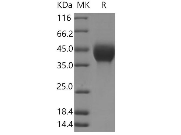 Human TGFB1 Recombinant Protein (RPES3198)