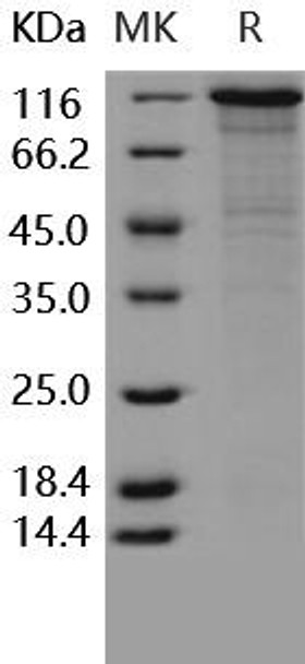 Human VE-Cadherin/CDH5 Recombinant Protein (His & Fc Tag) (Active) (RPES3256)