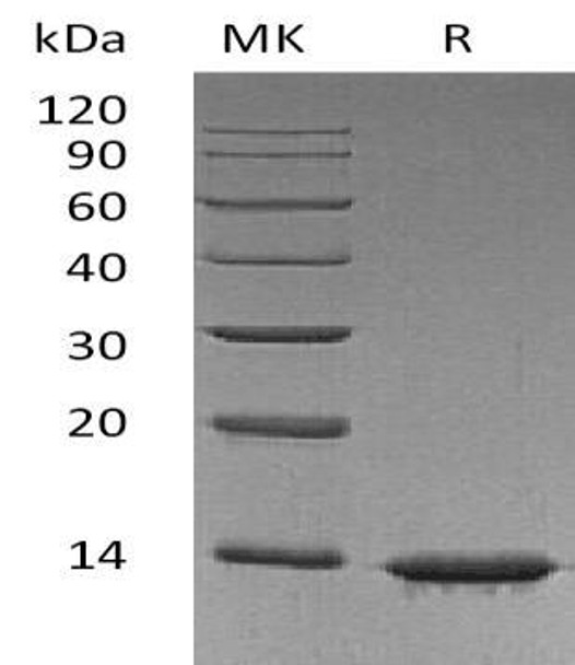 Human Leptin Recombinant Protein  (RPES3264)