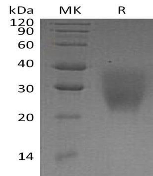Human LRRC25 Recombinant Protein (RPES3304)