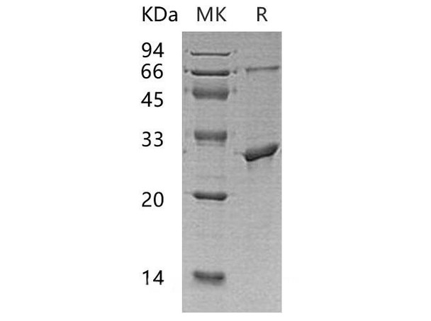 Human PPM1G/PP2C-gamma Recombinant Protein (RPES3325)