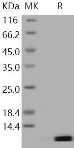 Human S100A12/CAGC Recombinant Protein (Active) (RPES3336)