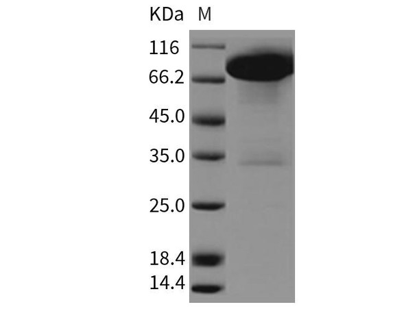 Rat DDR1 Kinase/CD167 Recombinant Protein (Fc Tag) (RPES3478)
