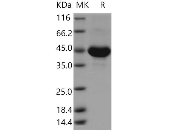 Human TSPAN8/Tetraspanin 8 Recombinant Protein (Fc Tag) (RPES3515)