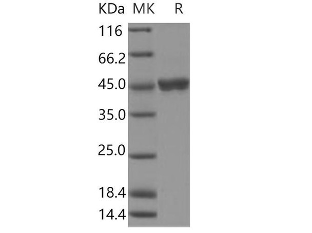 Human Gastric Lipase/LIPF Recombinant Protein (Baculovirus, His Tag) (RPES3522)