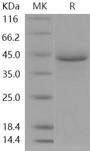 Human LRPAP1/A2MRAP Recombinant Protein (His Tag) (Active) (RPES3580)
