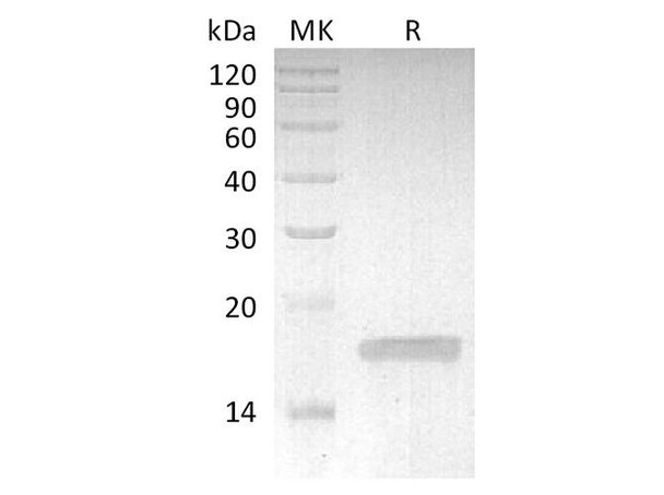 Rabbit TNF-alpha/TNFSF2/TNFa Recombinant Protein (RPES3618)