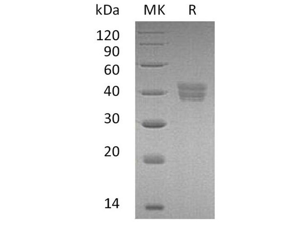 Human HtrA2/Omi Recombinant Protein (RPES3658)