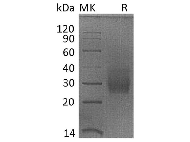 Rhesus macaque HVEM/TNFRSF14 Recombinant Protein (RPES3684)