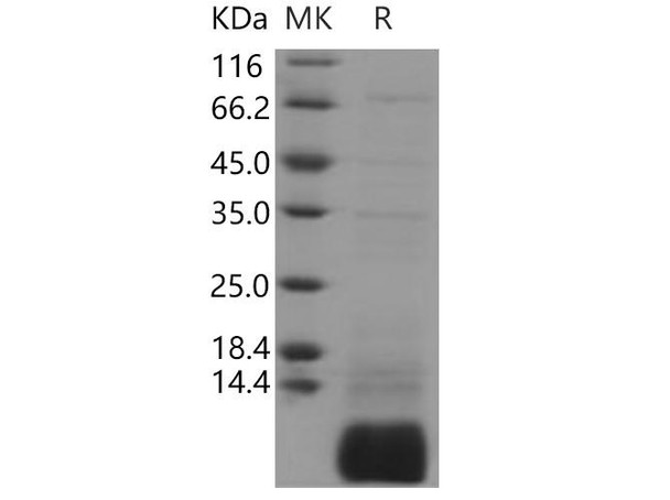 Human GNGT1/GNG1 Recombinant Protein (His Tag) (RPES3734)