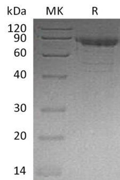Human Cadherin1/CDH11 Recombinant Protein (RPES3736)