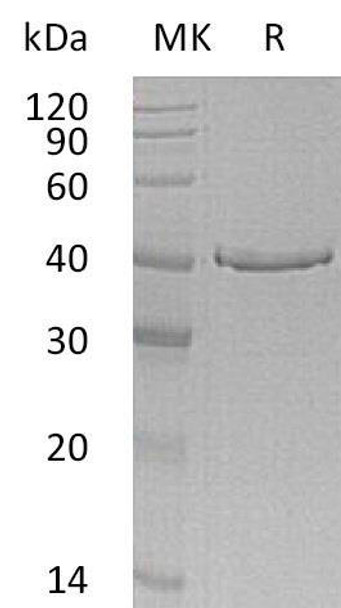 Human GMPR Recombinant Protein (E.coli, His Tag) (RPES3792)