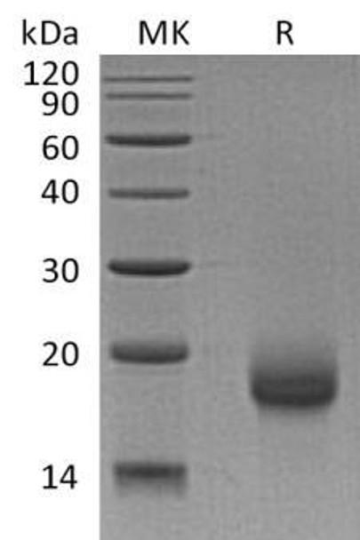 Human LY6H Recombinant Protein (RPES3803)
