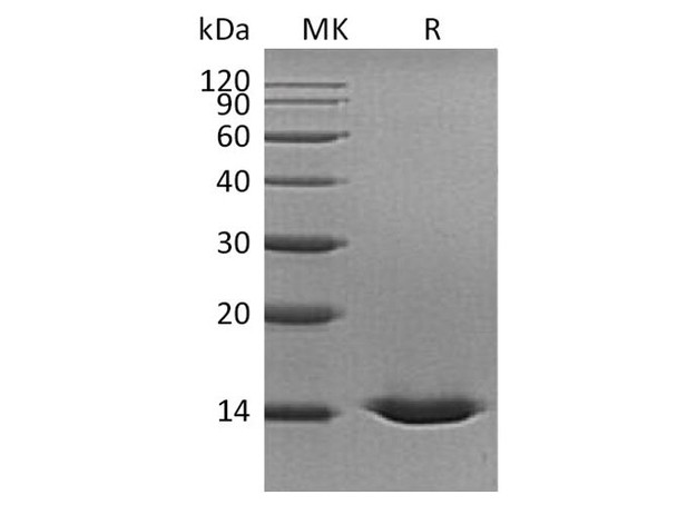 Human Cystatin D Recombinant Protein (RPES3810)