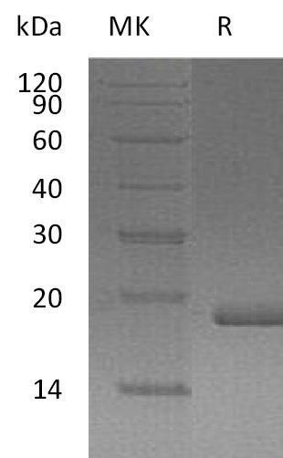 Human FGF0/FGF10 Recombinant Protein (RPES3823)