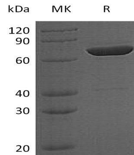 Human LCP2 Recombinant Protein (RPES3824)