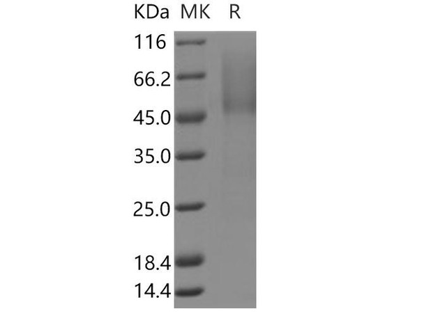 Human PARM1/PARM Recombinant Protein (His Tag) (RPES3923)