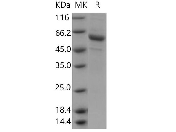 Human PSG6/PSG10 Recombinant Protein (His Tag) (RPES3944)