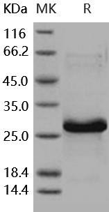 Human HSP27/HSPB1 Recombinant Protein (His Tag) (RPES3947)