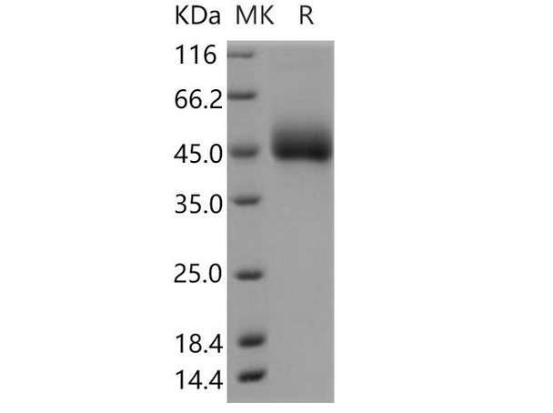 Human DPEP2 Recombinant Protein (His Tag) (RPES3966)