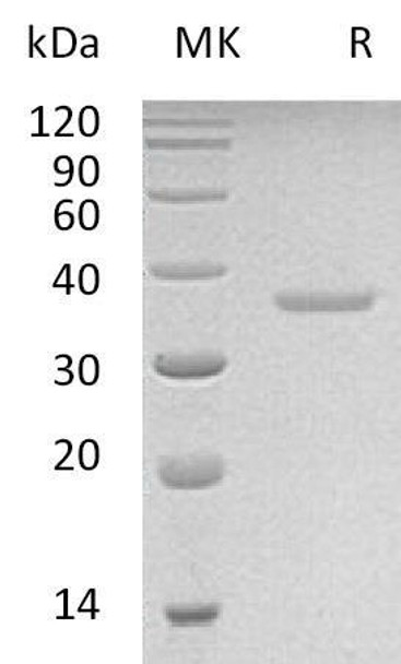 Human PRPS2 Recombinant Protein (RPES3977)