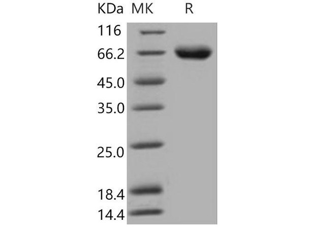 Mouse KIRREL1/NEPH1 Recombinant Protein (His Tag) (Active) (RPES4015)