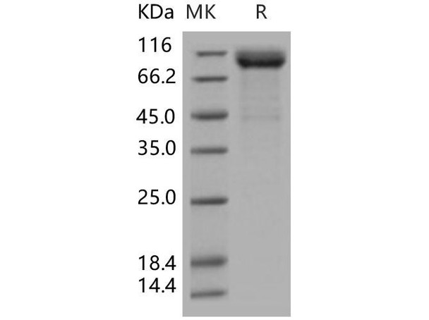 Human LIMP-2/LIMPII Recombinant Protein (His & Fc Tag) (Active) (RPES4032)