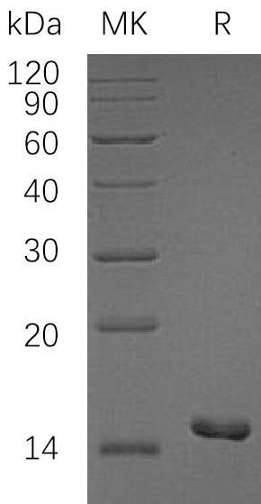 Human PKIB/PKI-Beta Recombinant Protein (RPES4086)