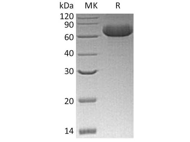 Human GFRRA2 Recombinant Protein (RPES4146)