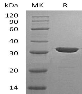 Carbonic Anhydrase 13/CA13 Recombinant Protein (RPES4181)