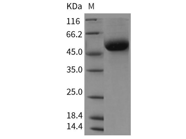 Rat DDR1 Kinase/CD167 Recombinant Protein (His Tag) (RPES4185)