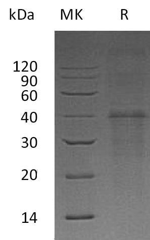 Carbonic Anhydrase 14/CA14 Recombinant Protein (RPES4205)