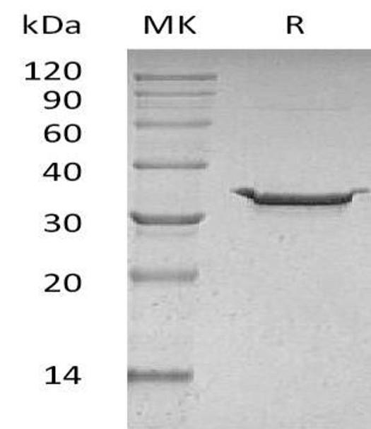 Carbonic Anhydrase 5B/CA5B Recombinant Protein (RPES4278)